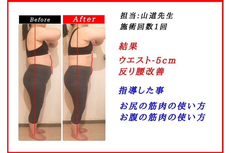 激変 同じ体重なのに 四ツ谷 新宿 の整体院